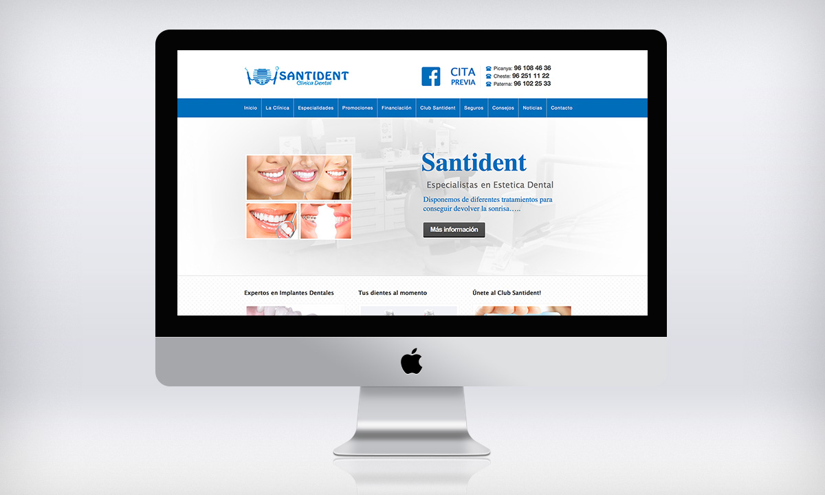 Diseño de pagina Web presencial para clínica dental en Valencia